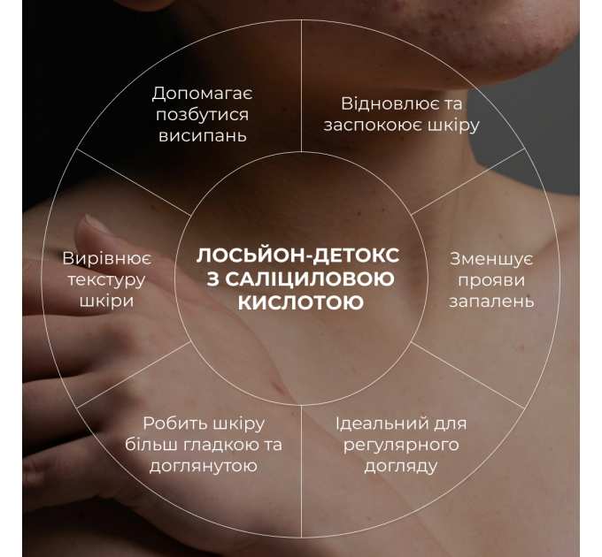Лосьйон-детокс для проблемної шкіри з саліциловою кислотою Hillary Anti-Acne Salicylic Body Lotion, 150 мл