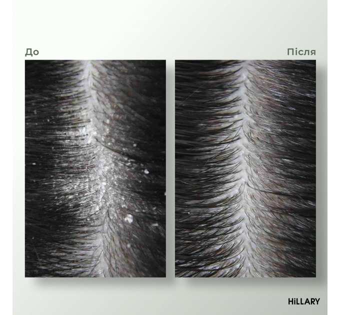 Комплекс HBS Оновлення Hillary Hair Body Skin Renewal