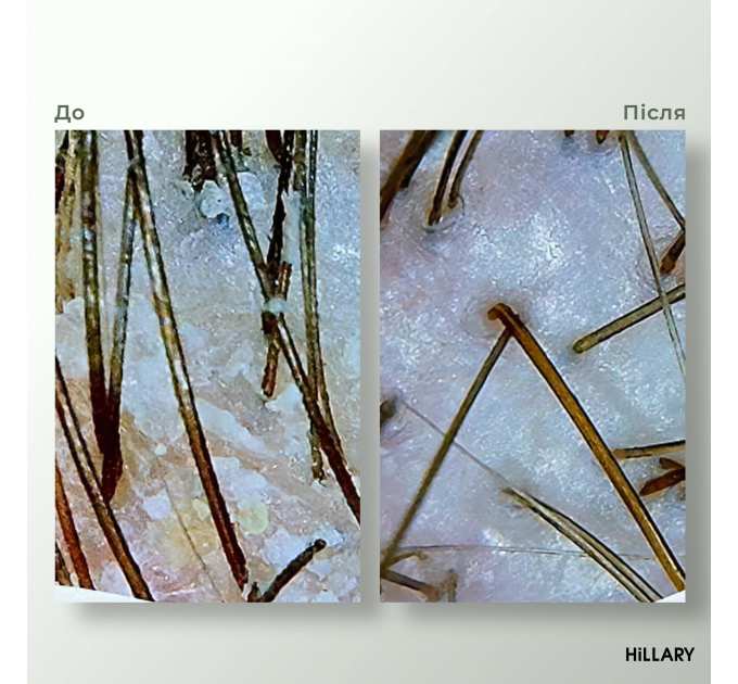 Комплекс HBS Оновлення Hillary Hair Body Skin Renewal